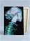 X-ray - Девушка на рентгене. p57449 - фото 13258